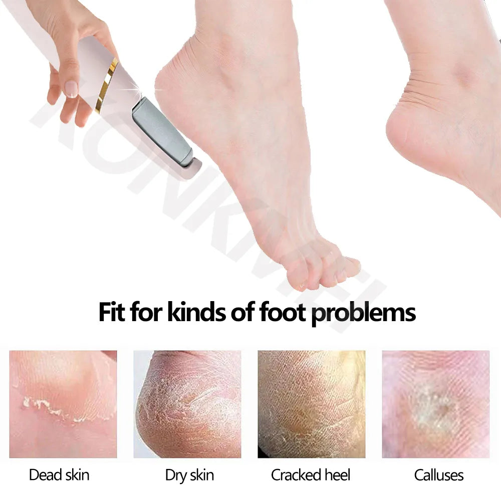 SoleSculpt Pro™ Electric Foot Care System