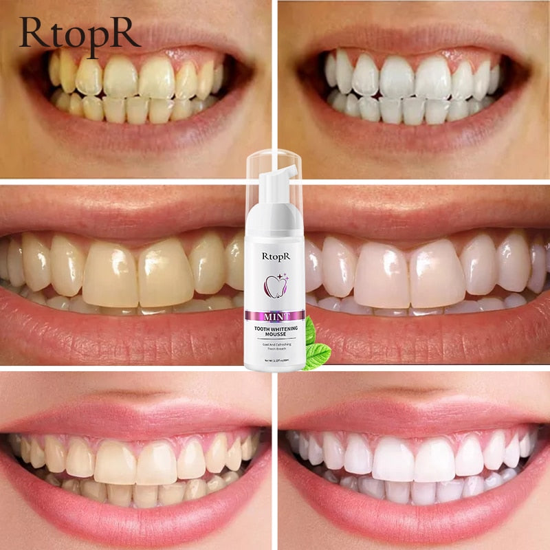 MintBright Teeth Whitening Mousse