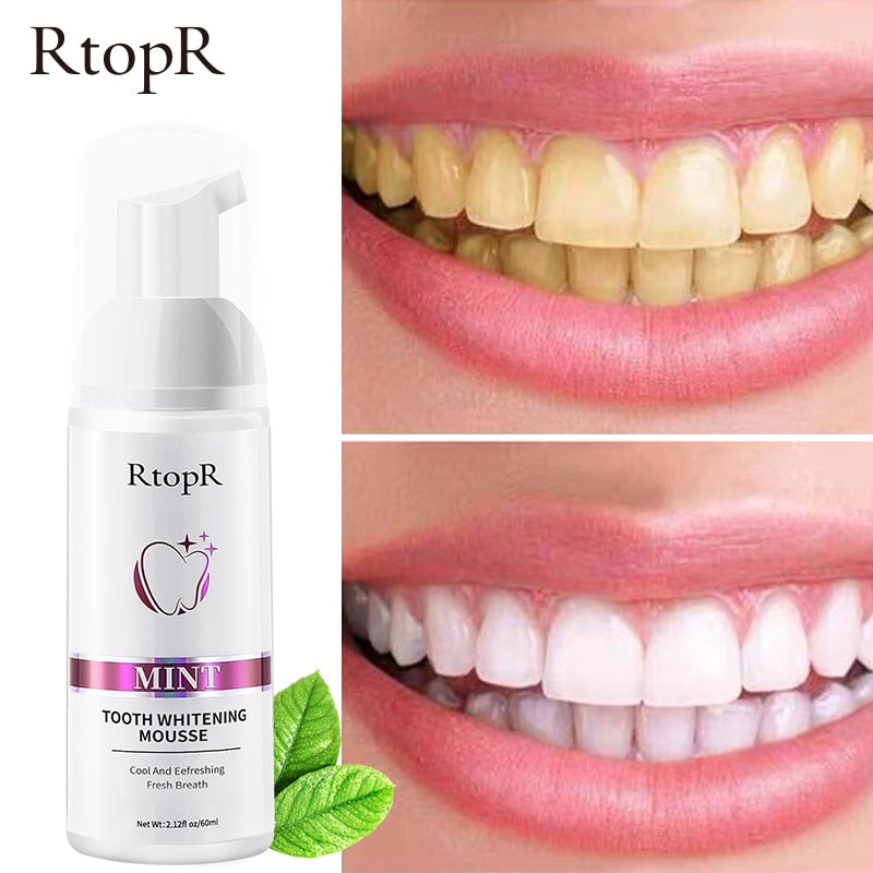 MintBright Teeth Whitening Mousse