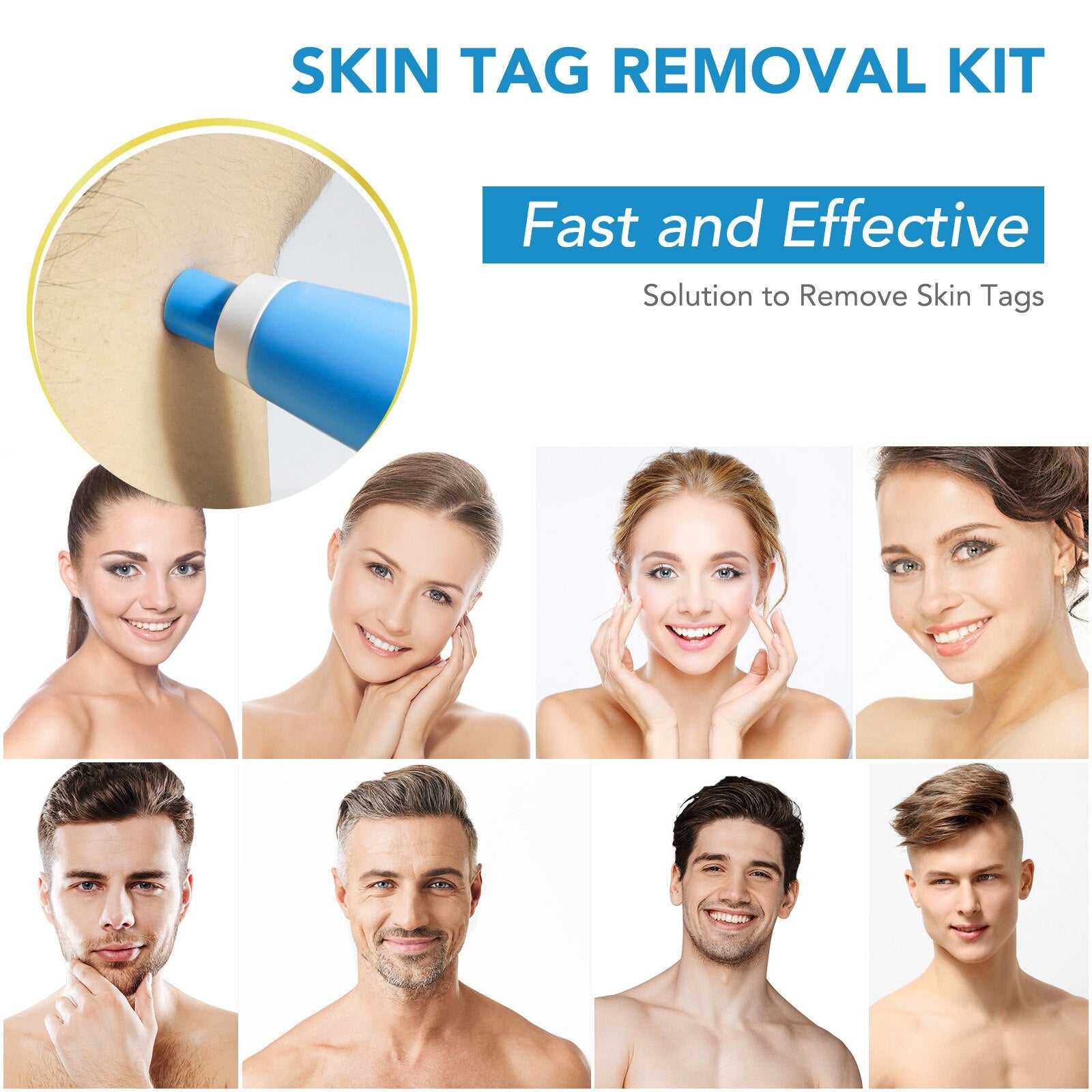 Skin Tag Remover